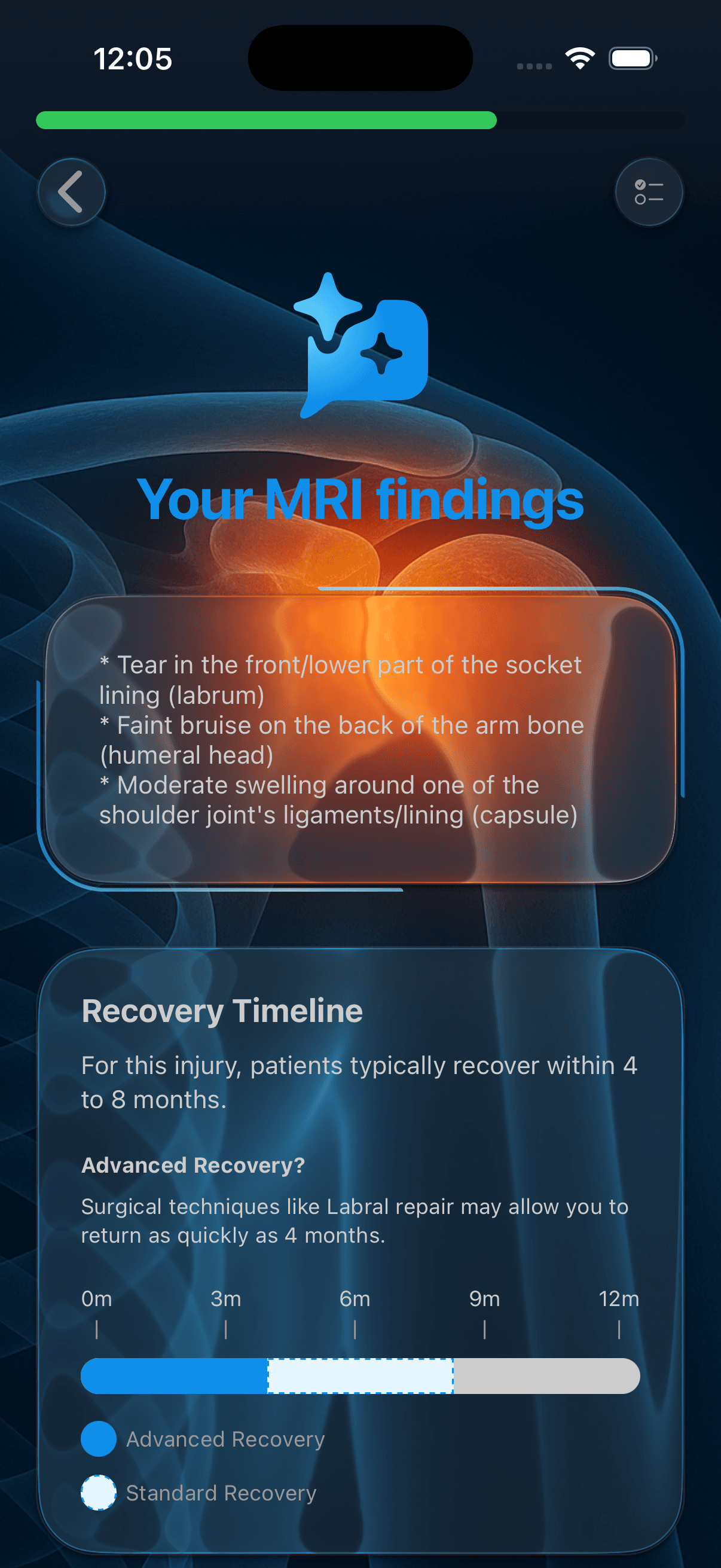 Report analysis view