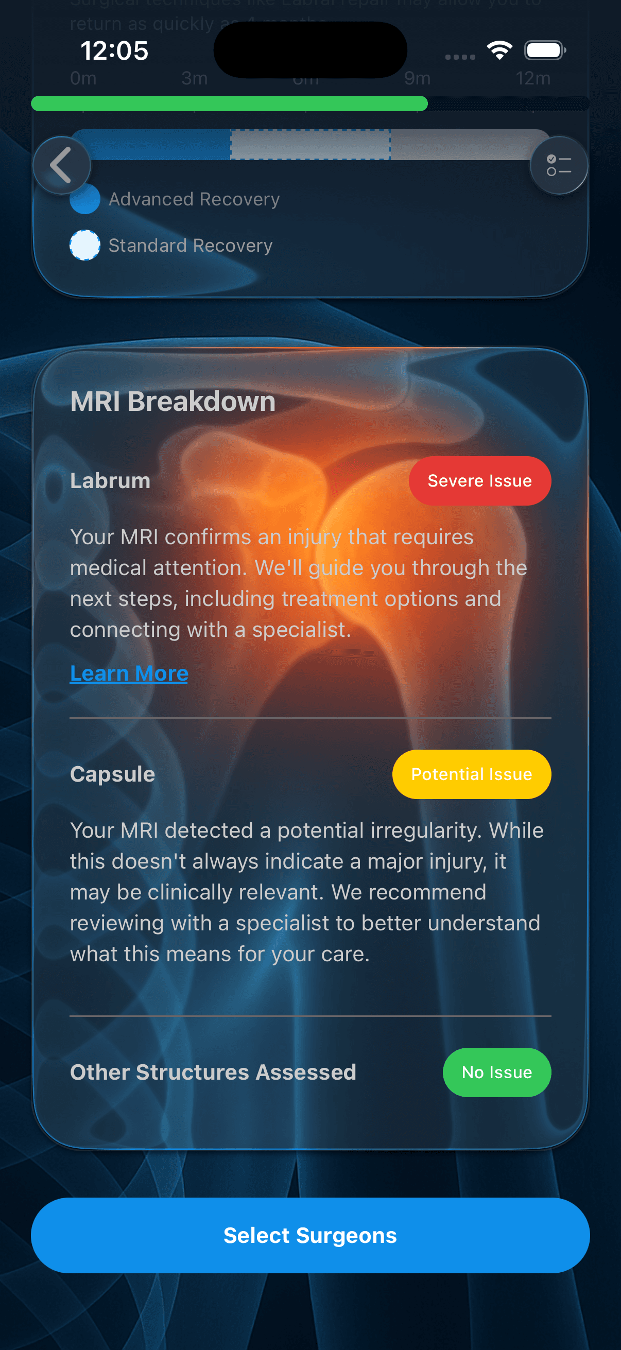 Report analysis second view